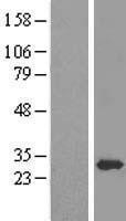NBL1-10124 - EEF1B2 Lysate