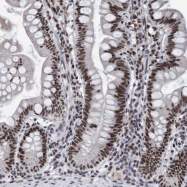 NBP1-87019 - U5-116 kDa / EFTUD2