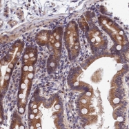 NBP1-83988 - EPB41L4B / EHM2