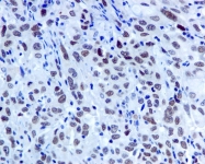 NBP1-95627 - BAT8