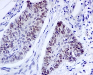NBP1-95627 - BAT8