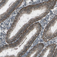 NBP1-83210 - EIF2AK1 / HRI