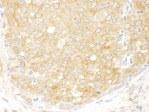 NB100-93284 - EIF2B / EIF2S2