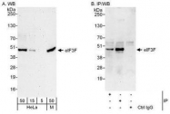 NBP1-50037 - EIF3F / EIF3S5