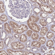 NBP1-91867 - 4E-BP3