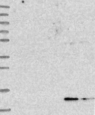 NBP1-91867 - 4E-BP3