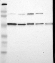 NBP1-86184 - EIF5