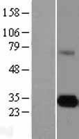 NBL1-10220 - ELA3A Lysate