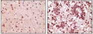 NBP1-47553 - ELK1