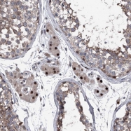NBP1-87092 - ELK4