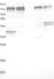 NBP1-88178 - ERC1 / ELKS