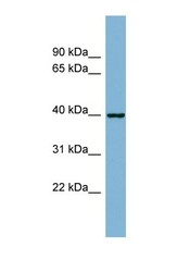 NBP1-59094 - ELMOD2