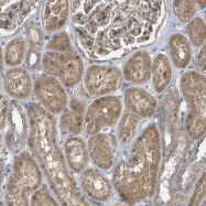 NBP1-85618 - ELOVL3