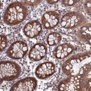NBP1-82082 - ELOVL6