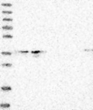 NBP1-93926 - ELOVL7
