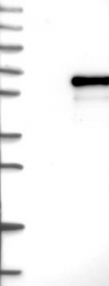 NBP1-84849 - EMID1 / EMU1
