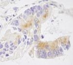 NBP1-05973 - EMAP4 / EML4