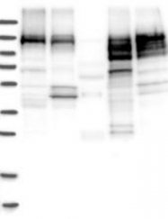 NBP1-86805 - EMAP4 / EML4