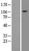 NBL1-10258 - EML4 Lysate