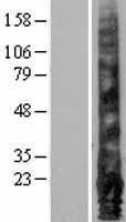 NBL1-10259 - EMP1 Lysate