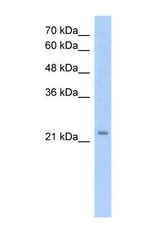 NBP1-62705 - EMP2 / XMP