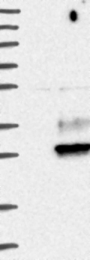 NBP1-86847 - EMP2 / XMP