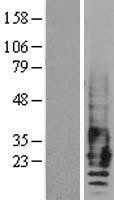NBL1-10260 - EMP2 Lysate