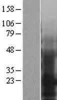 NBL1-10261 - EMP3 Lysate