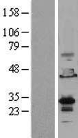NBL1-10262 - EMX2 Lysate