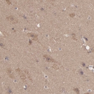 NBP1-85821 - Enolase beta