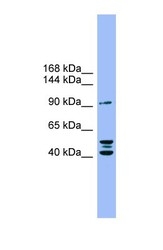 NBP1-59852 - Autotaxin / ENPP2