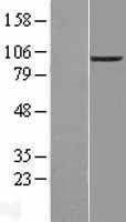 NBL1-10275 - ENPP2 Lysate