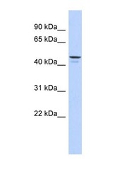 NBP1-57954 - ENPP6