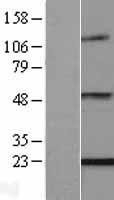 NBL1-10278 - ENPP6 Lysate