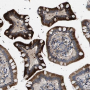 NBP1-85752 - ENTPD2 / CD39L1