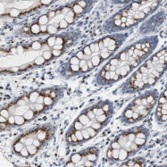 NBP1-81510 - ENTPD4