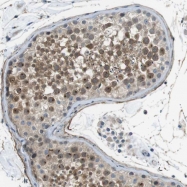 NBP1-82030 - ENTPD7 / LALP1