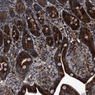NBP1-82517 - ENTPD8