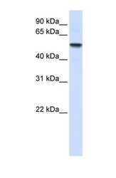 NBP1-59484 - ENTPD8