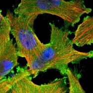 NBP1-89371 - EPB41 / Protein 4.1