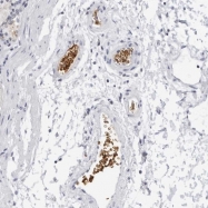 NBP1-89371 - EPB41 / Protein 4.1