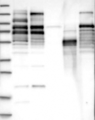 NBP1-89371 - EPB41 / Protein 4.1