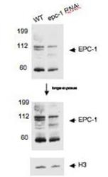 29560002 - EPC1