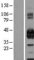 NBL1-14804 - EPCR Lysate