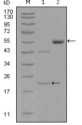 NBP1-47387 - EPHA5