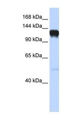 NBP1-53105 - EPHA5