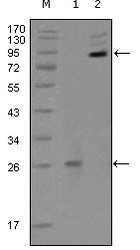 NBP1-47525 - EPHB2