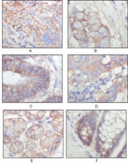 NBP1-47522 - EPHB3