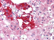 NBP1-47522 - EPHB3