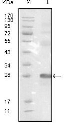 NBP1-47522 - EPHB3